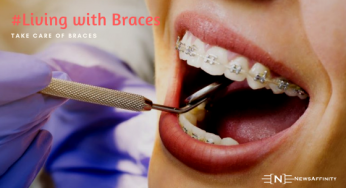 Precautions You Must Take After Installation of Braces