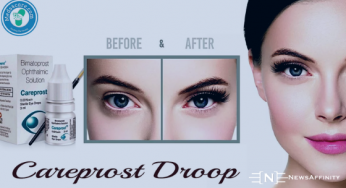 How enhancing your physical features becoming a must for personal glow-up