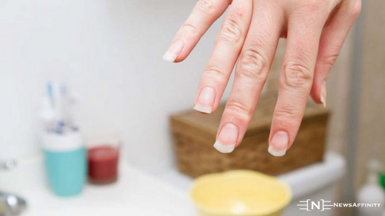 How to Take Proper Care of Your Nails